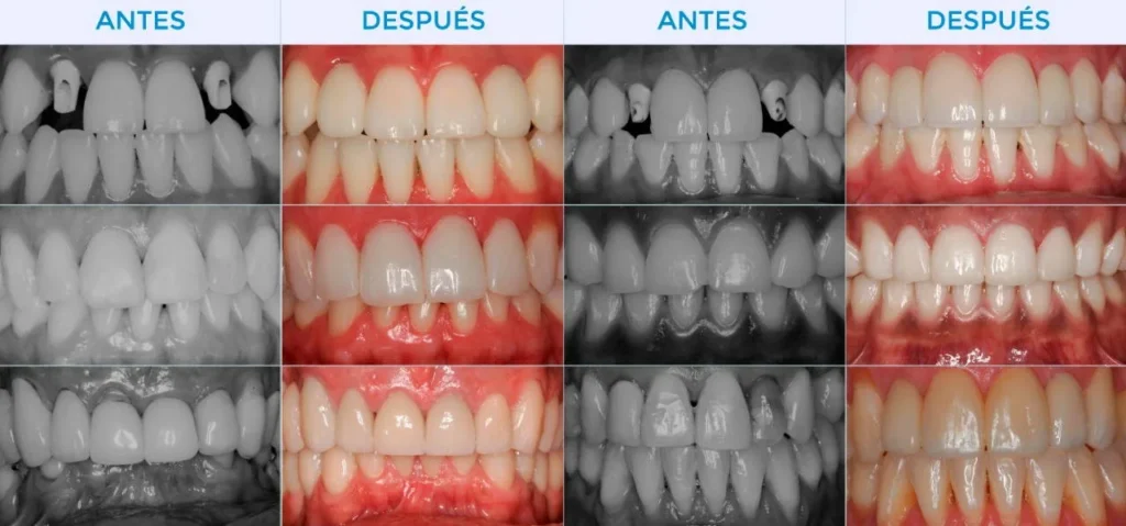 casos-sonrisas