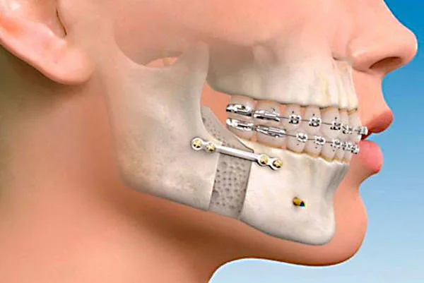 maxilofacial