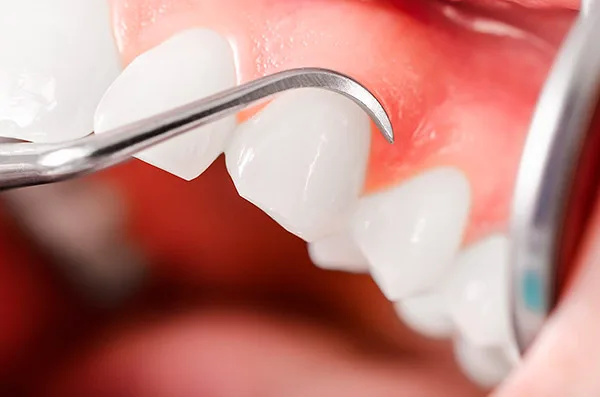 periodoncia